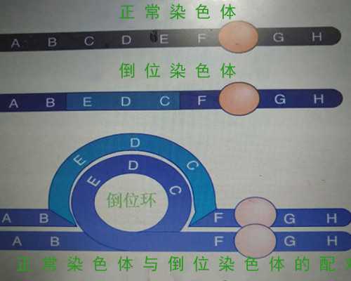 从长沙去美国进行三代试管助孕费用一般多少？_卵巢性闭经