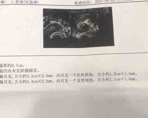 亲,美国辅助生殖协会对你说......