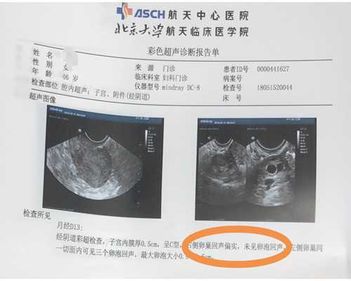 从长沙去美国进行三代试管助孕费用一般多少?_胚胎移植