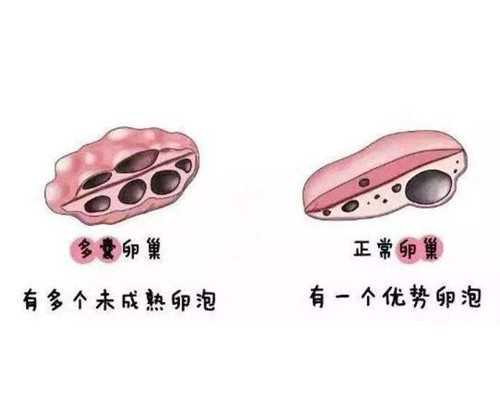 婴儿退烧小方法,如何安全有效地退婴儿烧热