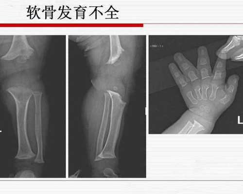 从长沙去美国做三代试管助孕需要注意哪些问题？-通过四维报告单就可以看男