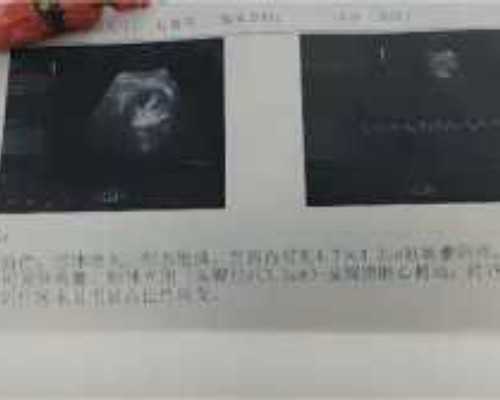 珠海精子库捐献一次多少钱咋样,珠海去美国生孩子怎么报销
